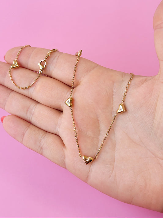 Love Club Choker Necklace